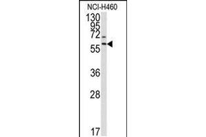 Western blot analysis of anti-MMP17 Antibody in NCI-H460 cell line lysates (35ug/lane).