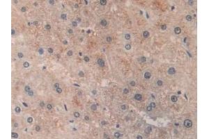 Detection of ACAT2 in Human Liver Tissue using Polyclonal Antibody to Acetyl Coenzyme A Acetyltransferase 2 (ACAT2) (ACAT2 antibody  (AA 1-397))