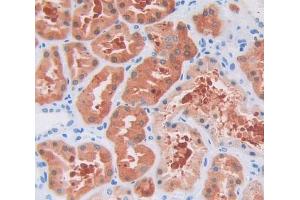 Used in DAB staining on fromalin fixed paraffin- embedded Kidney tissue (UXT antibody  (AA 15-157))