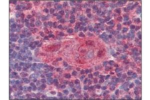 Immunohistochemistry (IHC) image for anti-Uracil-DNA Glycosylase (UNG) (AA 1-313), (N-Term) antibody (ABIN317576) (UNG antibody  (N-Term))