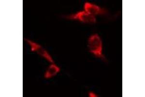 ABIN6275496 staining RAW264. (ARHGEF12 antibody  (Internal Region))