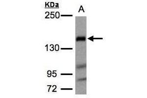 WB Image Sample(30 ug whole cell lysate) A:Raji , 5% SDS PAGE antibody diluted at 1:1000 (Flightless I antibody  (Internal Region))