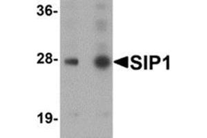 Western blot analysis of SIP1 in HeLa cell lysate with SIP1 antibody at (A) 0.