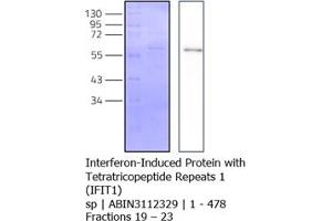 Western Blotting (WB) image for Interferon-Induced Protein with Tetratricopeptide Repeats 1 (IFIT1) (AA 1-478) protein (Strep Tag) (ABIN3112329) (IFIT1 Protein (AA 1-478) (Strep Tag))