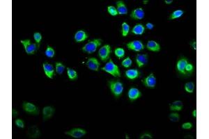 Immunofluorescence staining of Hela cells with ABIN7167104 at 1:133, counter-stained with DAPI. (RAPGEF2 antibody  (AA 1393-1498))