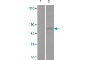 Western blot analysis of Lane 1: antigen-specific peptide treated JK cells, Lane 2: JK cells with DDR1 (phospho Y513) polyclonal antibody  at 1:500-1000 dilution.