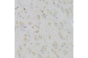 Immunohistochemistry of paraffin-embedded mouse brain using MAP2K5 Antibody (ABIN5974181) at dilution of 1/100 (40x lens). (MAP2K5 antibody)