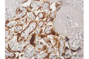 Immunoperoxidase of purified MaxPab antibody to CSH2 on formalin-fixed paraffin-embedded human placenta. (CSH1 antibody  (AA 1-217))