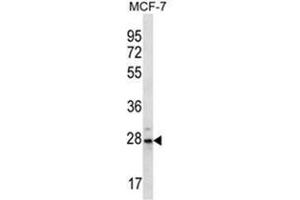 Western blot analysis of PSMB10 Antibody (C-term) in MCF-7 cell line lysates (35ug/lane).