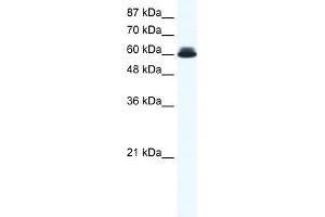 WB Suggested Anti-DDX27 Antibody Titration:  0. (DDX27 antibody  (N-Term))