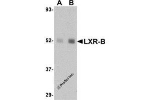 Western Blotting (WB) image for anti-Nuclear Receptor Subfamily 1, Group H, Member 2 (NR1H2) (N-Term) antibody (ABIN1031444)