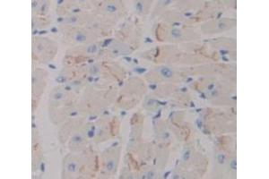 IHC-P analysis of Kidney tissue, with DAB staining. (ADCY7 antibody  (AA 309-491))