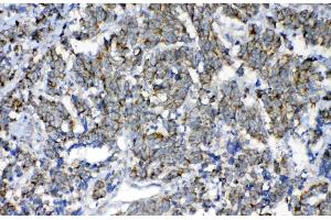 IHC analysis of FH using anti-FH antibody . (FH antibody)