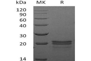 Western Blotting (WB) image for Vascular Endothelial Growth Factor A (VEGFA) protein (ABIN7320681) (VEGFA Protein)