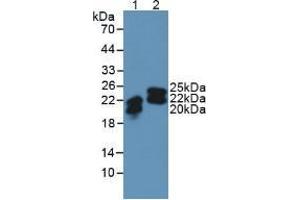 Western blot analysis of (1) Human SW480 Cells and (2) Human Urine. (Lipocalin 2 antibody  (AA 21-198))