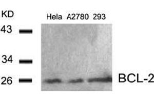 Image no. 3 for anti-B-Cell CLL/lymphoma 2 (BCL2) (AA 54-58) antibody (ABIN197203) (Bcl-2 antibody  (AA 54-58))