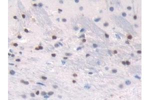 Detection of TALDO1 in Mouse Cerebrum Tissue using Polyclonal Antibody to Transaldolase (TALDO1) (TALDO1 antibody  (AA 35-285))