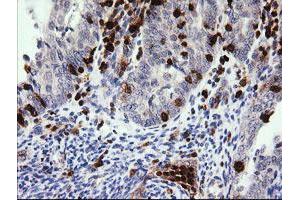 Image no. 2 for anti-Phosphoinositide-3-Kinase, Catalytic, gamma Polypeptide (PIK3CG) antibody (ABIN1500202) (PIK3 gamma antibody)