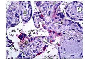 Human Placenta: Formalin-Fixed, Parraffin-Embedded (FFPE) (DOK3 antibody  (C-Term))