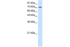 WB Suggested Anti-ZBTB48 Antibody Titration:  0. (ZBTB48 antibody  (N-Term))