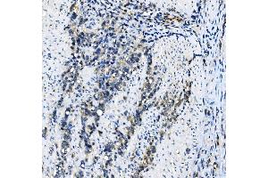IHC analysis of EIF4A1 using anti-EIF4A1 antibody (ABIN7603143). (EIF4A1 antibody  (N-Term))