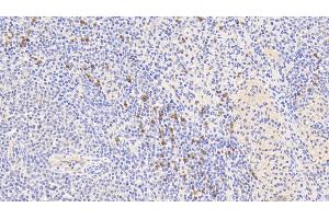 Detection of S100A9 in Human Spleen Tissue using Polyclonal Antibody to S100 Calcium Binding Protein A9 (S100A9) (S100A9 antibody  (AA 1-114))