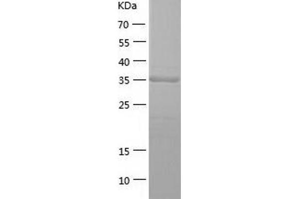 PSAT1 Protein (AA 1-370) (His tag)