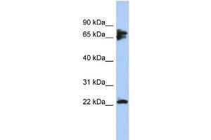 WB Suggested Anti-PPP3R1 Antibody Titration: 0. (PPP3R1 antibody  (N-Term))