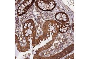 Immunohistochemical staining of human colon with MARK4 polyclonal antibody  shows moderate cytoplasmic positivity in glandular cells. (MARK4 antibody)
