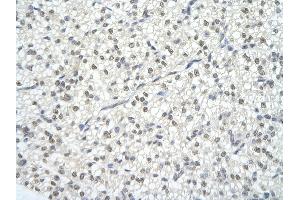 Rabbit Anti-XPO1 antibody   Paraffin Embedded Tissue: Human Heart cell Cellular Data: cardiac cell of renal tubule Antibody Concentration: 4.