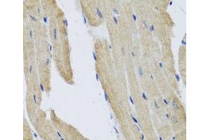 Immunohistochemistry of paraffin-embedded Mouse heart using PRPH Polyclonal Antibody at dilution of 1:100 (40x lens). (Peripherin antibody)