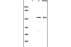 L1 human colon carcinoma lysates L2 rat brain lysates probed with Anti- WT-1/Wilms Tumor Protein Polyclonal Antibody, Unconjugated (ABIN1386293) at 1:200 in 4 °C. (WT1 antibody  (AA 301-400))