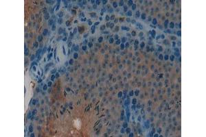 #VALUE! (CGB antibody  (AA 55-153))