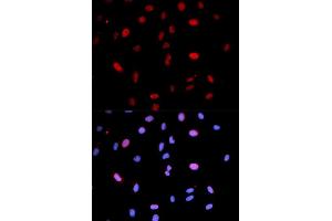 Immunofluorescence analysis of U2OS cells using Phospho-MAP2K6-S207/MAP2K3-S189 antibody (ABIN5969926). (MAP2K6 antibody  (pSer207))