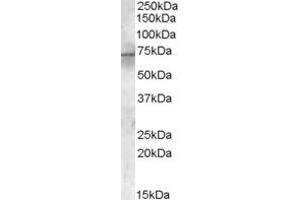 Western Blotting (WB) image for anti-Coiled-Coil Domain Containing 79 (CCDC79) (C-Term) antibody (ABIN2156555) (CCDC79 antibody  (C-Term))