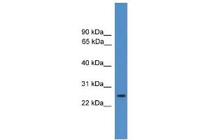 WB Suggested Anti-EIF4E2 Antibody Titration: 0. (EIF4E2 antibody  (N-Term))