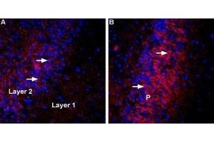 Expression of VGLUT3 in rat and mouse brain - Immunohistochemical staining of perfusion-fixed frozen rat and mouse brain sections using Anti-VGLUT3 Antibody (ABIN7043680, ABIN7044372 and ABIN7044373), (1:400), followed by anti-rabbit-Cy3 antibody (red). (SLC17A8 antibody  (Cytosolic))