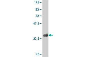 Western Blot detection against Immunogen (35. (CysLTR1 antibody  (AA 248-337))