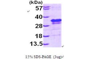 SDS-PAGE (SDS) image for Eukaryotic Translation Initiation Factor 4E (EIF4E) (AA 1-217) protein (His tag) (ABIN667809)