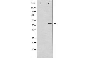 Western blot analysis of CDC25A phosphorylation expression in UV treated A2780 whole cell lysates,The lane on the left is treated with the antigen-specific peptide. (CDC25A antibody  (pSer75))