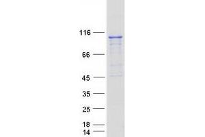 Validation with Western Blot (PRP6/ANT-1 Protein (Myc-DYKDDDDK Tag))
