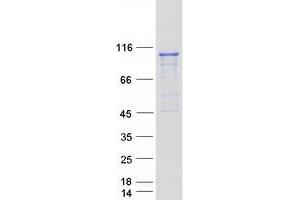 PRP6/ANT-1 Protein (Myc-DYKDDDDK Tag)