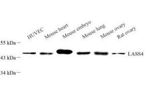 Western blot analysis of LASS4 (ABIN7073433) at dilution of 1: 1000 (LASS4 antibody)