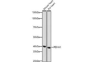 Western blot analysis of extracts of various cell lines, using PDH antibody (7432) at 1:1000 dilution. (PDHA1 antibody)