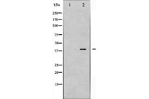 Western Blotting (WB) image for anti-Protein Kinase, AMP-Activated, beta 1 Non-Catalytic Subunit (PRKAB1) (pSer181) antibody (ABIN6255041)
