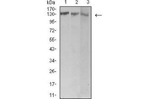 Western blot analysis using BCR mouse mAb against Jurkat (1), Hela (2), and Ramos (3) cell lysate. (BCR antibody  (AA 139-280))