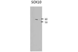 Western Blotting (WB) image for anti-SRY (Sex Determining Region Y)-Box 10 (SOX10) (Middle Region) antibody (ABIN2777864)