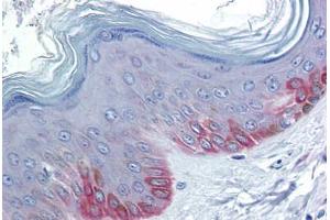 Human Skin: Formalin-Fixed, Paraffin-Embedded (FFPE) (FZD5 antibody  (AA 467-516))