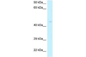 WB Suggested Anti-RPP40 Antibody Titration: 1. (RPP40 antibody  (N-Term))