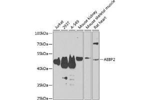 Western blot analysis of extracts of various cell lines, using  antibody (ABIN6131366, ABIN6136608, ABIN6136609 and ABIN6223268) at 1:1000 dilution. (AEBP2 antibody  (AA 234-503))